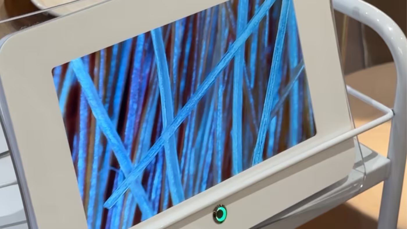 Pantalla del capilógrafo mostrando las fibras capilares ampliadas